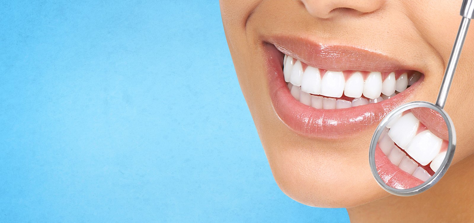 Dental Crowns Treatment in Noida 