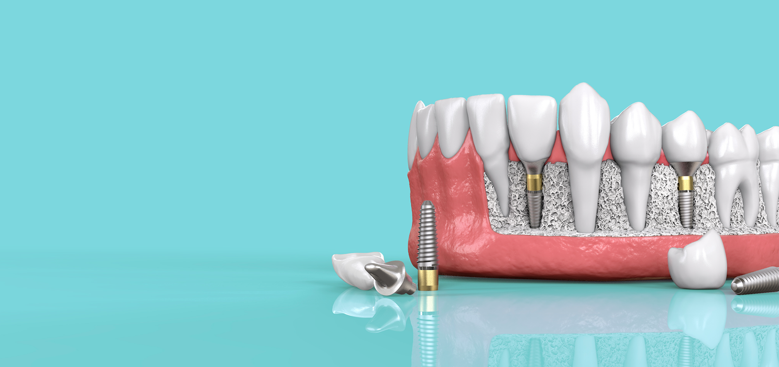 Cosmetic Dentistry in Noida