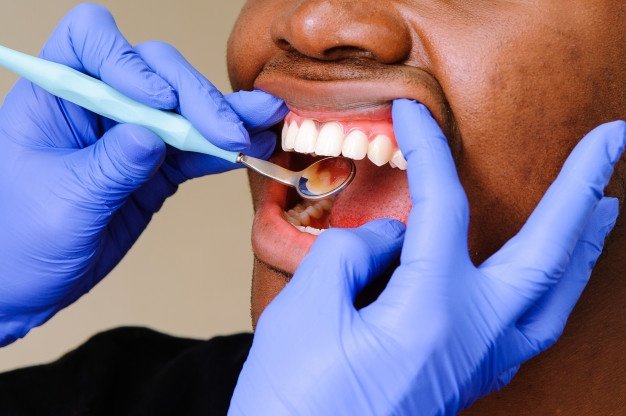 Teeth Scaling Treatment in Noida